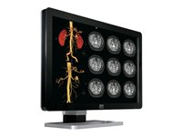 Barco Coronis Fusion 4MP DL (MDCC-4130) - LCD-skärm - 4MP - färg - 30" - med Barco MXRT-5450-grafikadapter K9602020